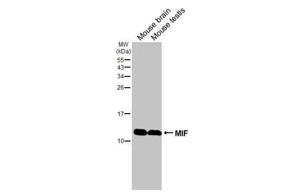 Various tissue extracts (50 μg) were separated by 15% SDS-PAGE, and the membrane was blotted with MIF antibody [HL2963] (GTX640350) diluted at 1:1000. The HRP-conjugated anti-rabbit IgG antibody (GTX213110-01) was used to detect the primary antibody.