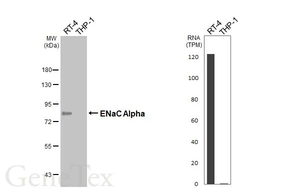 Various whole cell extracts (30 μg) were separated by 7.5% SDS-PAGE, and the membrane was blotted with ENaC Alpha antibody [HL2967] (GTX640354) diluted at 1:500. The HRP-conjugated anti-rabbit IgG antibody (GTX213110-01) was used to detect the primary antibody, and the signal was developed with Trident femto Western HRP Substrate. Corresponding RNA expression data for the same cell lines are based on Human Protein Atlas program.