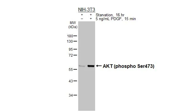 Untreated (–) and treated (+) NIH-3T3 whole cell extracts (30 μg) were separated by 10% SDS-PAGE, and the membrane was blotted with AKT (phospho Ser473) antibody [HL2971] (GTX640358) diluted at 1:1000. The HRP-conjugated anti-rabbit IgG antibody (GTX213110-01) was used to detect the primary antibody.