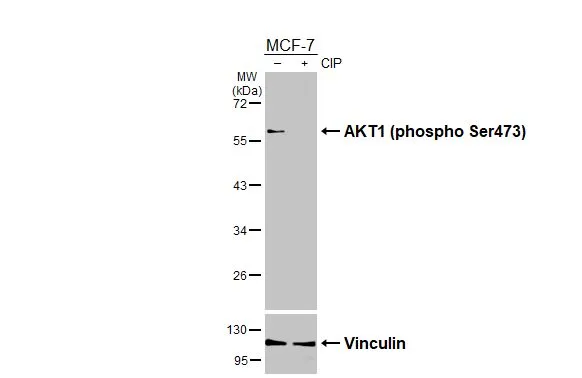 Untreated (–) and treated (+) MCF-7 whole cell extracts (30 μg) were separated by 10% SDS-PAGE, and the membrane was blotted with AKT1 (phospho Ser473) antibody [HL2972] (GTX640359) diluted at 1:2000. The HRP-conjugated anti-rabbit IgG antibody (GTX213110-01) was used to detect the primary antibody.