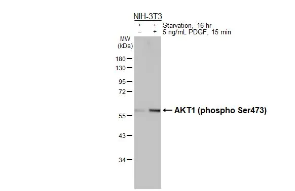 Untreated (–) and treated (+) NIH-3T3 whole cell extracts (30 μg) were separated by 10% SDS-PAGE, and the membrane was blotted with AKT1 (phospho Ser473) antibody [HL2972] (GTX640359) diluted at 1:1000. The HRP-conjugated anti-rabbit IgG antibody (GTX213110-01) was used to detect the primary antibody.