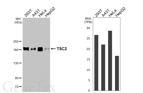 TSC2 antibody [HL2974]
