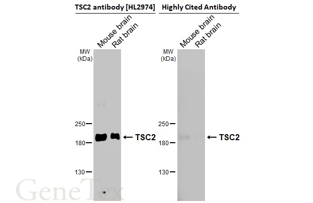 TSC2 antibody [HL2974]
