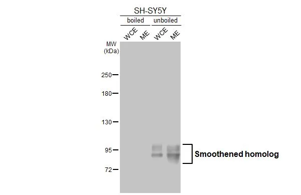 Boiled and unboiled SH-SY5Y whole cell and membrane extracts (30 μg) were separated by 5% SDS-PAGE, and the membrane was blotted with Smoothened homolog antibody [HL2975] (GTX640362) diluted at 1:1000. The HRP-conjugated anti-rabbit IgG antibody (GTX213110-01) was used to detect the primary antibody. (WCE: whole cell extract; ME: membrane extract)