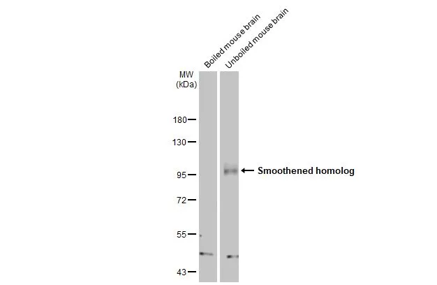 Boiled and unboiled mouse brain extract (50 μg) were separated by 7.5% SDS-PAGE, and the membrane was blotted with Smoothened homolog antibody [HL2975] (GTX640362) diluted at 1:1000. The HRP-conjugated anti-rabbit IgG antibody (GTX213110-01) was used to detect the primary antibody, and the signal was developed with Trident femto Western HRP Substrate.