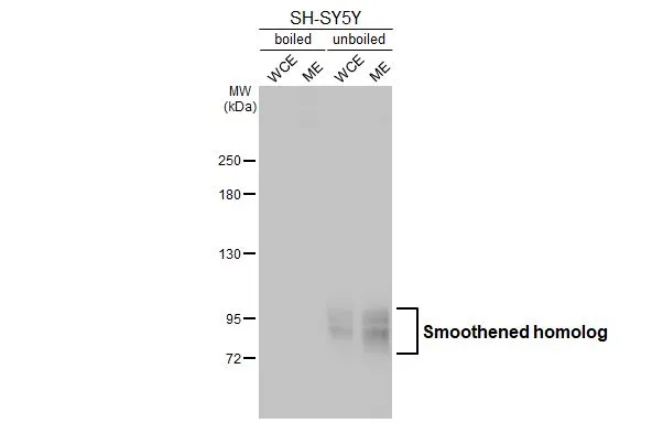 Boiled and unboiled SH-SY5Y whole cell and membrane extracts (30 μg) were separated by 5% SDS-PAGE, and the membrane was blotted with Smoothened homolog antibody [HL2976] (GTX640363) diluted at 1:1000. The HRP-conjugated anti-rabbit IgG antibody (GTX213110-01) was used to detect the primary antibody. (WCE: whole cell extract; ME: membrane extract)