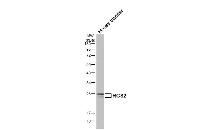 Whole tissue extract (50 μg) was separated by 12% SDS-PAGE, and the membrane was blotted with RGS2 antibody [HL2988] (GTX640398) diluted at 1:1000. The HRP-conjugated anti-rabbit IgG antibody (GTX213110-01) was used to detect the primary antibody, and the signal was developed with Trident ECL plus-Enhanced.