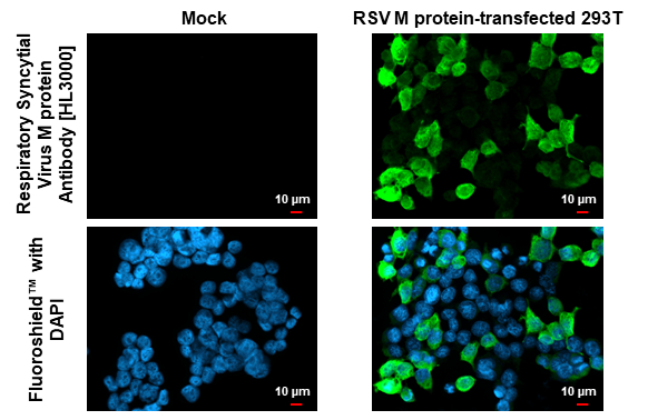 Respiratory Syncytial Virus M protein Antibody [HL3000] detects Respiratory Syncytial Virus M protein Antibody protein by immunofluorescent analysis. Sample: Mock and transfected 293T cells were fixed in ice-cold MeOH for 5 min. Green: Respiratory Syncytial Virus M Antibody stained by Respiratory Syncytial Virus M protein Antibody [HL3000] (GTX640410) diluted at 1:500. Blue: Fluoroshield with DAPI (GTX30920).