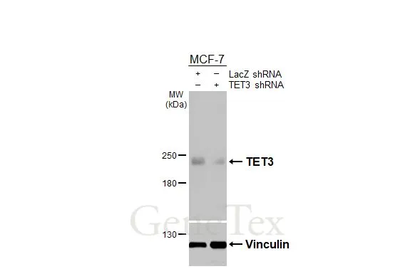 Non-transfected (–) and transfected (+) MCF-7 whole cell extracts (30 μg) were separated by 5% SDS-PAGE, and the membrane was blotted with TET3 antibody [HL3009] (GTX640422) diluted at 1:1000. The HRP-conjugated anti-rabbit IgG antibody (GTX213110-01) was used to detect the primary antibody, and the signal was developed with Trident ECL plus-Enhanced.