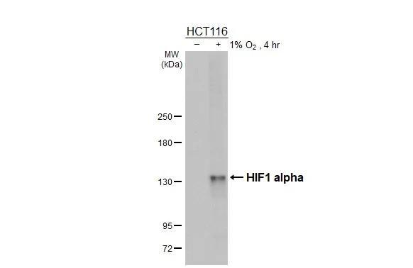 Untreated (–) and treated (+) HCT116 whole cell extracts (30 μg) were separated by 5% SDS-PAGE, and the membrane was blotted with HIF1 alpha antibody [HL3011] (GTX640424) diluted at 1:1000. The HRP-conjugated anti-rabbit IgG antibody (GTX213110-01) was used to detect the primary antibody.