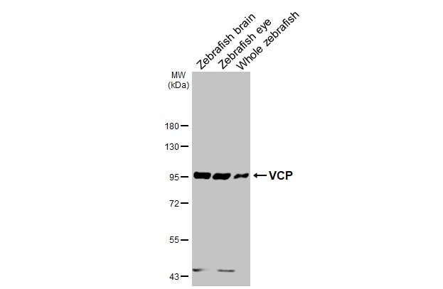 Various tissue extracts (30 μg) were separated by 7.5% SDS-PAGE, and the membrane was blotted with VCP antibody [HL3018] (GTX640431) diluted at 1:1000. The HRP-conjugated anti-rabbit IgG antibody (GTX213110-01) was used to detect the primary antibody.