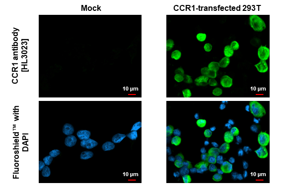 CCR1 antibody [HL3023] detects CCR1 protein by immunofluorescent analysis. Sample: Mock and transfected 293T cells were fixed in ice-cold MeOH for 5 min. Green: CCR1 stained by CCR1 antibody [HL3023] (GTX640436) diluted at 1:500. Blue: Fluoroshield with DAPI (GTX30920).
