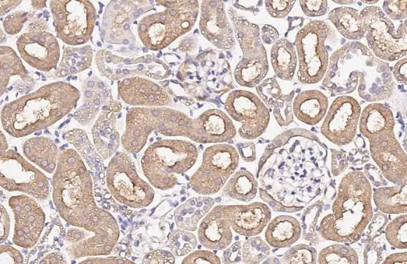 ENaC Alpha antibody [HL3027]
