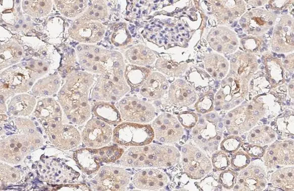 ENaC Alpha antibody [HL3027]