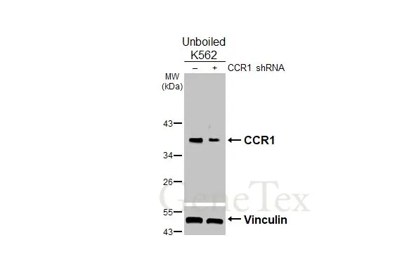 Non-transfected (–) and transfected (+) unboiled K562 whole cell extracts (50 μg) were separated by 10% SDS-PAGE, and the membrane was blotted with CCR1 antibody [HL3034] (GTX640472) diluted at 1:500. The HRP-conjugated anti-rabbit IgG antibody (GTX213110-01) was used to detect the primary antibody, and the signal was developed with Trident femto Western HRP Substrate.