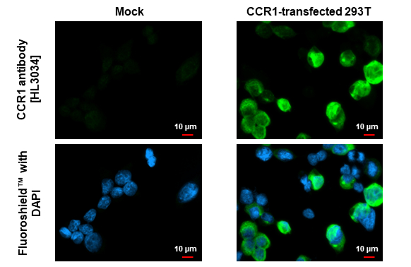 CCR1 antibody [HL3034] detects CCR1 protein by immunofluorescent analysis. Sample: Mock and transfected 293T cells were fixed in ice-cold MeOH for 5 min. Green: CCR1 stained by CCR1 antibody [HL3034] (GTX640472) diluted at 1:500. Blue: Fluoroshield with DAPI (GTX30920).