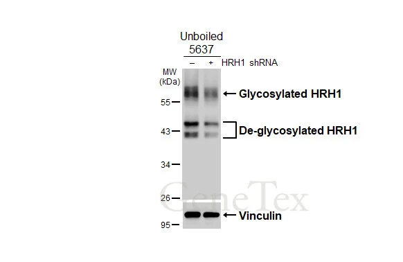 Non-transfected (–) and transfected (+) unboiled 5637 whole cell extracts (30 μg) were separated by 10% SDS-PAGE, and the membrane was blotted with HRH1 antibody [HL3037] (GTX640475) diluted at 1:1000. The HRP-conjugated anti-rabbit IgG antibody (GTX213110-01) was used to detect the primary antibody.