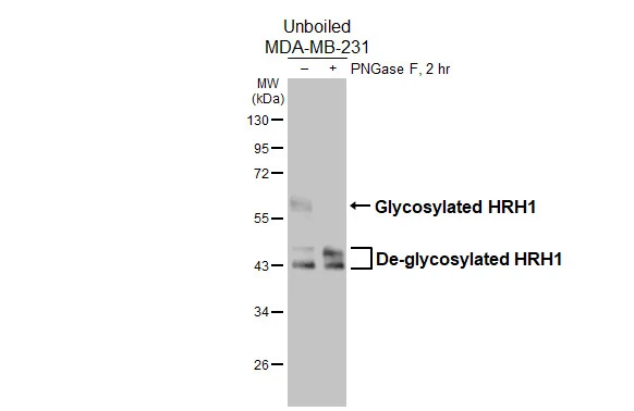 Untreated (–) and treated (+) unboiled MDA-MB-231 whole cell extracts (30 μg) were separated by 10% SDS-PAGE, and the membrane was blotted with HRH1 antibody [HL3037] (GTX640475) diluted at 1:1000. The HRP-conjugated anti-rabbit IgG antibody (GTX213110-01) was used to detect the primary antibody, and the signal was developed with Trident femto Western HRP Substrate.