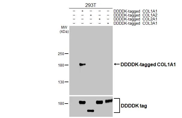 Non-transfected (–) and transfected (+) 293T whole cell extracts were separated by 5% SDS-PAGE, and the membrane was blotted with COL1A1 antibody [HL3040] (GTX640483) diluted at 1:5000. The HRP-conjugated anti-rabbit IgG antibody (GTX213110-01) was used to detect the primary antibody.