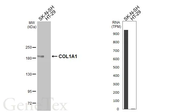 Various whole cell extracts (30 μg) were separated by 5% SDS-PAGE, and the membrane was blotted with COL1A1 antibody [HL3040] (GTX640483) diluted at 1:1000. The HRP-conjugated anti-rabbit IgG antibody (GTX213110-01) was used to detect the primary antibody. Corresponding RNA expression data for the same cell lines are based on Human Protein Atlas program.
