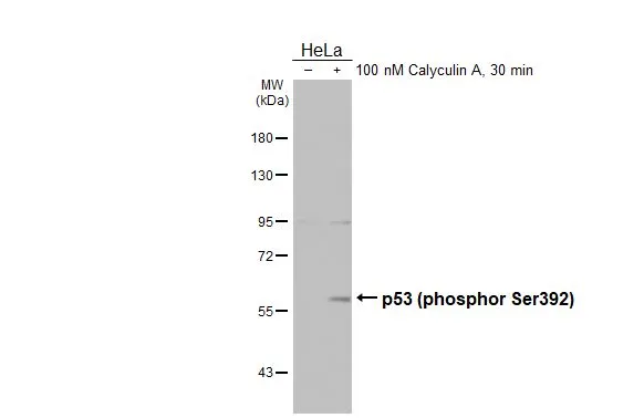 Untreated (–) and treated (+) HeLa whole cell extracts (30 μg) were separated by 7.5% SDS-PAGE, and the membrane was blotted with p53 (phospho Ser392) antibody [HL3047] (GTX640490) diluted at 1:500. The HRP-conjugated anti-rabbit IgG antibody (GTX213110-01) was used to detect the primary antibody, and the signal was developed with Trident ECL plus-Enhanced.