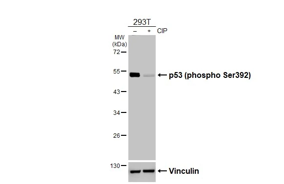 Untreated (–) and treated (+) 293T whole cell extracts (30 μg) were separated by 10% SDS-PAGE, and the membrane was blotted with p53 (phospho Ser392) antibody [HL3047] (GTX640490) diluted at 1:1000. The HRP-conjugated anti-rabbit IgG antibody (GTX213110-01) was used to detect the primary antibody.