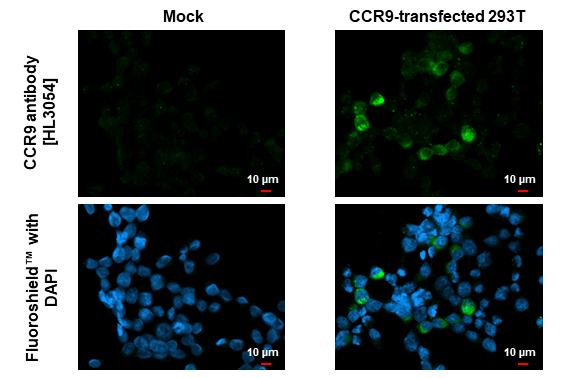 CCR9 antibody [HL3054] detects CCR9 protein by immunofluorescent analysis. Sample: Mock and transfected 293T cells were fixed in ice-cold MeOH for 5 min. Green: CCR9 stained by CCR9 antibody [HL3054] (GTX640497) diluted at 1:500. Blue: Fluoroshield with DAPI (GTX30920).