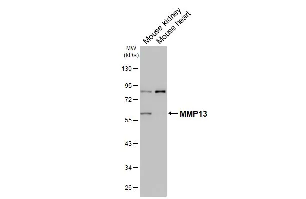Various tissue extracts (50 μg) were separated by 10% SDS-PAGE, and the membrane was blotted with MMP13 antibody [HL3067] (GTX640513) diluted at 1:1000. The HRP-conjugated anti-rabbit IgG antibody (GTX213110-01) was used to detect the primary antibody.