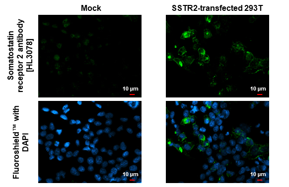 Somatostatin receptor 2 antibody [HL3078] detects Somatostatin receptor 2 protein by immunofluorescent analysis. Sample: Mock and transfected 293T cells were fixed in ice-cold MeOH for 5 min. Green: Somatostatin receptor 2 stained by Somatostatin receptor 2 antibody [HL3078] (GTX640524) diluted at 1:500. Blue: Fluoroshield with DAPI (GTX30920).
