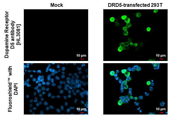Dopamine Receptor D5 antibody [HL3081] detects Dopamine Receptor D5 protein by immunofluorescent analysis. Sample: Mock and transfected 293T cells were fixed in ice-cold MeOH for 5 min. Green: Dopamine Receptor D5 stained by Dopamine Receptor D5 antibody [HL3081] (GTX640527) diluted at 1:500. Blue: Fluoroshield with DAPI (GTX30920).