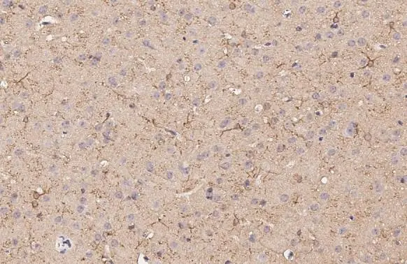 Dopamine Receptor D5 antibody [HL3081] detects Dopamine Receptor D5 protein by immunohistochemical analysis. Sample: Paraffin-embedded mouse brain. Dopamine Receptor D5 stained by Dopamine Receptor D5 antibody [HL3081] (GTX640527) diluted at 1:100. Antigen Retrieval: Citrate buffer, pH 6.0, 15 min