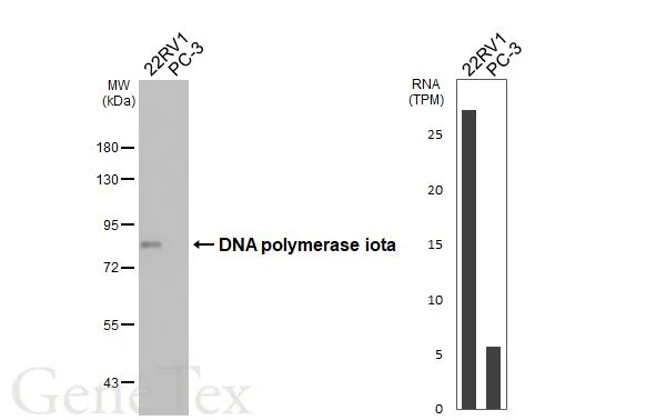 Various whole cell extracts (30 μg) were separated by 7.5% SDS-PAGE, and the membrane was blotted with DNA polymerase iota antibody [HL3115] (GTX640591) diluted at 1:1000. The HRP-conjugated anti-rabbit IgG antibody (GTX213110-01) was used to detect the primary antibody, and the signal was developed with Trident ECL plus-Enhanced. Corresponding RNA expression data for the same cell lines are based on Human Protein Atlas program.