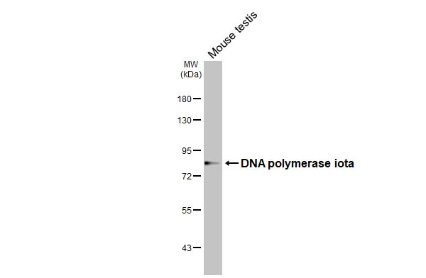 Mouse tissue extract (50 μg) was separated by 7.5% SDS-PAGE, and the membrane was blotted with DNA polymerase iota antibody [HL3115] (GTX640591) diluted at 1:1000. The HRP-conjugated anti-rabbit IgG antibody (GTX213110-01) was used to detect the primary antibody, and the signal was developed with Trident ECL plus-Enhanced.