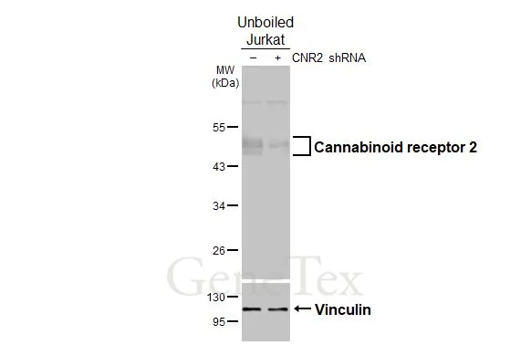 Non-transfected (–) and transfected (+) unboiled Jurkat whole cell extracts (30 μg) were separated by 10% SDS-PAGE, and the membrane was blotted with Cannabinoid receptor 2 antibody [HL3120] (GTX640596) diluted at 1:500. The HRP-conjugated anti-rabbit IgG antibody (GTX213110-01) was used to detect the primary antibody, and the signal was developed with Trident ECL plus-Enhanced.