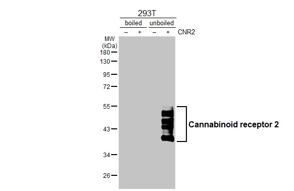 Non-transfected (–) and transfected (+) boiled and unboiled 293T whole cell extracts (30 μg) were separated by 10% SDS-PAGE, and the membrane was blotted with Cannabinoid receptor 2 antibody [HL3120] (GTX640596) diluted at 1:5000. The HRP-conjugated anti-rabbit IgG antibody (GTX213110-01) was used to detect the primary antibody.