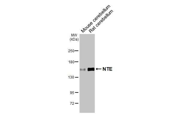 Various tissue extracts (50 μg) were separated by 5% SDS-PAGE, and the membrane was blotted with NTE antibody [HL3127] (GTX640613) diluted at 1:1000. The HRP-conjugated anti-rabbit IgG antibody (GTX213110-01) was used to detect the primary antibody.