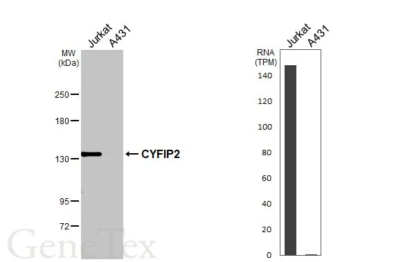 Various whole cell extracts (30 μg) were separated by 5% SDS-PAGE, and the membrane was blotted with CYFIP2 antibody [HL3148] (GTX640658) diluted at 1:1000. The HRP-conjugated anti-rabbit IgG antibody (GTX213110-01) was used to detect the primary antibody. Corresponding RNA expression data for the same cell lines are based on Human Protein Atlas program.