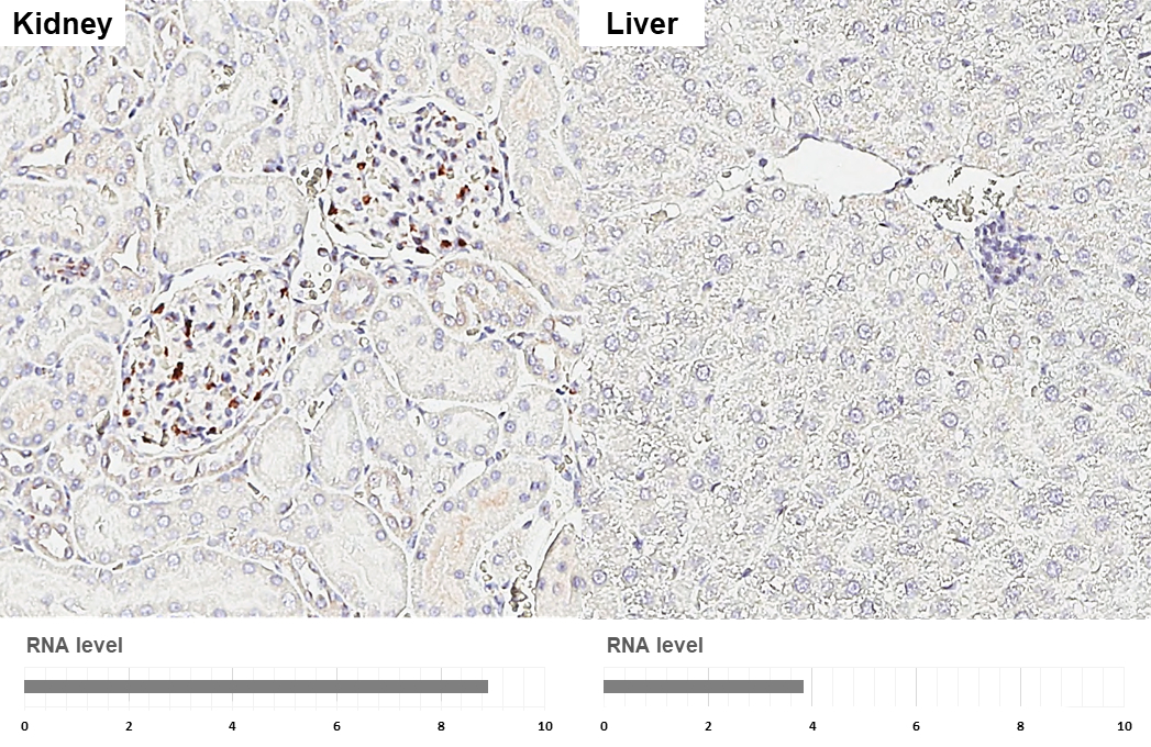 HIF1 alpha antibody [HL3154] detects HIF1 alpha protein by immunohistochemical analysis. Sample: Paraffin-embedded rat tissues. HIF1 alpha stained by HIF1 alpha antibody [HL3154] (GTX640664) diluted at 1:100. Antigen Retrieval: Citrate buffer, pH 6.0, 15 min