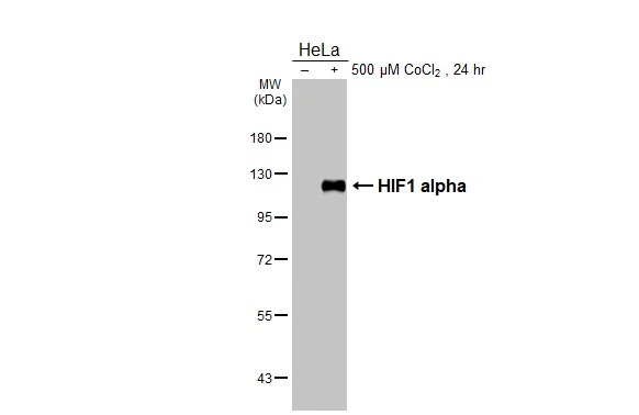 Untreated (–) and treated (+) HeLa whole cell extract (30 μg) were separated by 7.5% SDS-PAGE, and the membrane was blotted with HIF1 alpha antibody [HL3154] (GTX640664) diluted at 1:1000. The HRP-conjugated anti-rabbit IgG antibody (GTX213110-01) was used to detect the primary antibody.