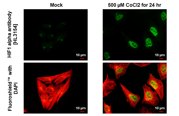 HIF1 alpha antibody [HL3154] detects HIF1 alpha protein by immunofluorescent analysis. Sample: Mock and treated HeLa cells were fixed in ice-cold MeOH for 5 min. Green: HIF1 alpha stained by HIF1 alpha antibody [HL3154] (GTX640664) diluted at 1:500. Red: alpha Tubulin, a cytoskeleton marker, stained by alpha Tubulin antibody [GT114] (GTX628802) diluted at 1:1000.