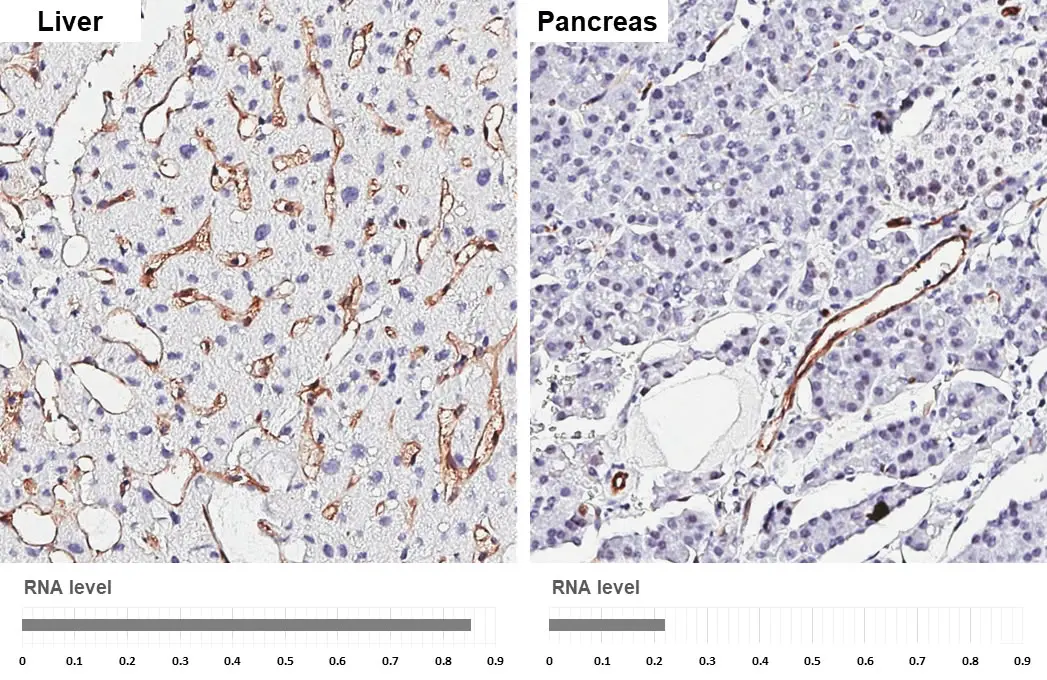 Claudin 5 antibody [HL3156] detects Claudin 5 protein by immunohistochemical analysis. Sample: Paraffin-embedded human tissues. Claudin 5 stained by Claudin 5 antibody [HL3156] (GTX640666) diluted at 1:3200. Antigen Retrieval: Tris-EDTA buffer, pH 9.0, 15 min