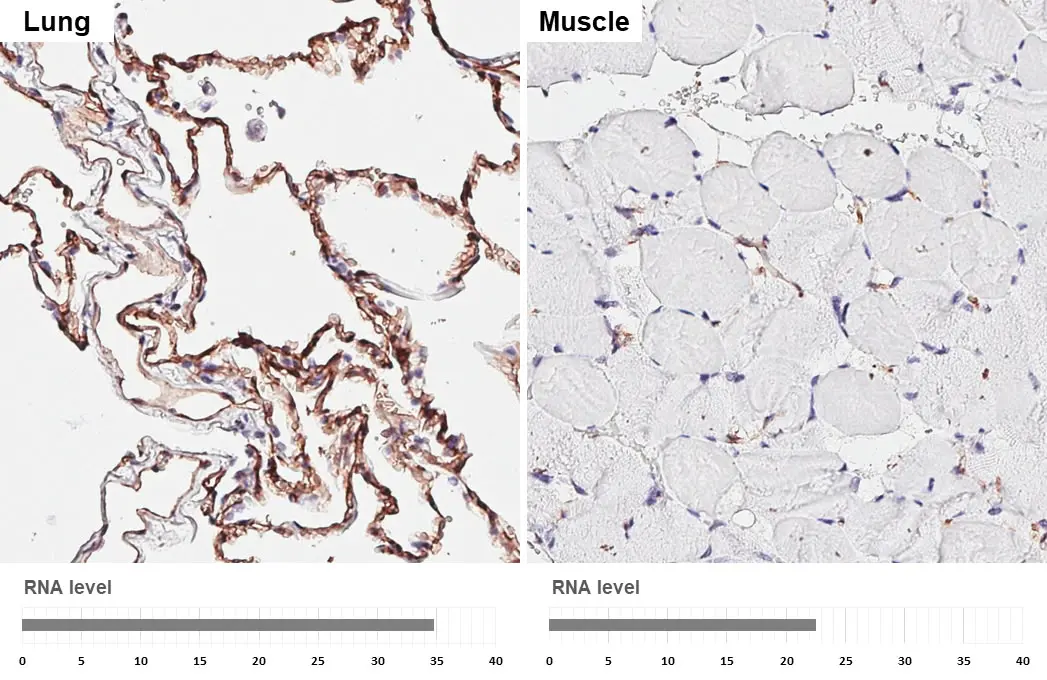 Claudin 5 antibody [HL3156] detects Claudin 5 protein by immunohistochemical analysis. Sample: Paraffin-embedded human tissues. Claudin 5 stained by Claudin 5 antibody [HL3156] (GTX640666) diluted at 1:3200. Antigen Retrieval: Tris-EDTA buffer, pH 9.0, 15 min