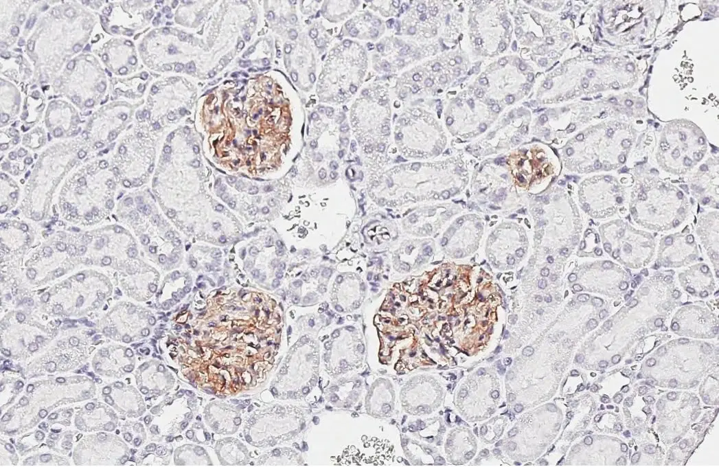 Claudin 5 antibody [HL3156] detects Claudin 5 protein by immunohistochemical analysis. Sample: Paraffin-embedded rat kidney. Claudin 5 stained by Claudin 5 antibody [HL3156] (GTX640666) diluted at 1:2000. Antigen Retrieval: Tris-EDTA buffer, pH 9.0, 15 min