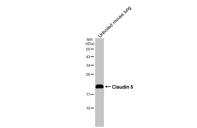 Unboiled mouse tissue extract (50 μg) was separated by 12% SDS-PAGE, and the membrane was blotted with Claudin 5 antibody [HL3156] (GTX640666) diluted at 1:1000. The HRP-conjugated anti-rabbit IgG antibody (GTX213110-01) was used to detect the primary antibody.