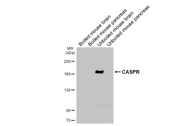 Boiled and unboiled various tissue extracts (50 μg) were separated by 5% SDS-PAGE, and the membrane was blotted with CASPR antibody [HL3160] (GTX640670) diluted at 1:1000. The HRP-conjugated anti-rabbit IgG antibody (GTX213110-01) was used to detect the primary antibody.