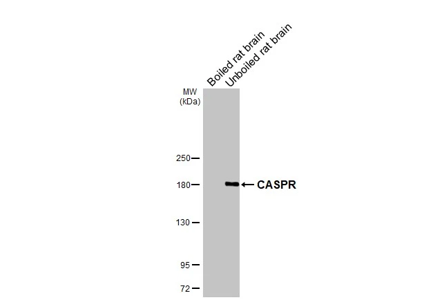 Boiled and unboiled rat tissue extracts (50 μg) were separated by 5% SDS-PAGE, and the membrane was blotted with CASPR antibody [HL3160] (GTX640670) diluted at 1:1000. The HRP-conjugated anti-rabbit IgG antibody (GTX213110-01) was used to detect the primary antibody.