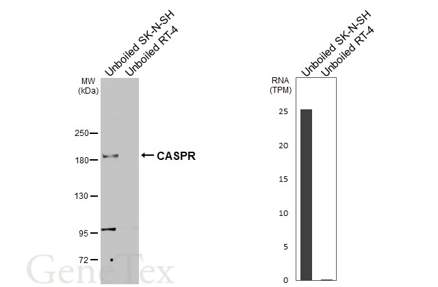 Unboiled various whole cell extracts (50 μg) were separated by 5% SDS-PAGE, and the membrane was blotted with CASPR antibody [HL3160] (GTX640670) diluted at 1:1000. The HRP-conjugated anti-rabbit IgG antibody (GTX213110-01) was used to detect the primary antibody, and the signal was developed with Trident ECL plus-Enhanced. Corresponding RNA expression data for the same cell lines are based on Human Protein Atlas program.