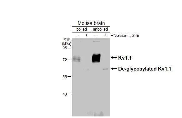 Untreated (–) and treated (+) boiled and unboiled mouse tissue extract (50 μg) were separated by 7.5% SDS-PAGE, and the membrane was blotted with Kv1.1 antibody [HL3162] (GTX640672) diluted at 1:1000. The HRP-conjugated anti-rabbit IgG antibody (GTX213110-01) was used to detect the primary antibody.