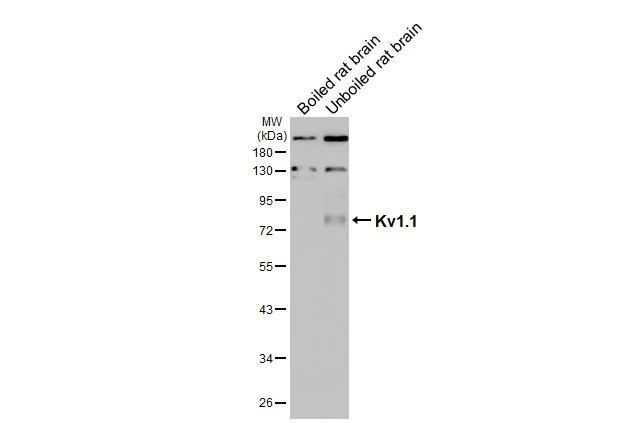 Boiled and unboiled rat tissue extract (50 μg) were separated by 10% SDS-PAGE, and the membrane was blotted with Kv1.1 antibody [HL3162] (GTX640672) diluted at 1:1000. The HRP-conjugated anti-rabbit IgG antibody (GTX213110-01) was used to detect the primary antibody, and the signal was developed with Trident ECL plus-Enhanced.