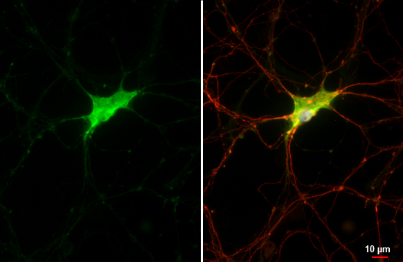 Kv1.2 antibody [HL3163] detects Kv1.2 protein by immunofluorescent analysis. Sample: DIV11 rat E18 primary hippocampal neuron cells were fixed in 4% paraformaldehyde at RT for 15 min. Green: Kv1.2 stained by Kv1.2 antibody [HL3163] (GTX640673) diluted at 1:250. Red: Tau, an axon marker, stained by Tau antibody [GT287] (GTX634809) diluted at 1:500. Blue: Fluoroshield with DAPI (GTX30920).